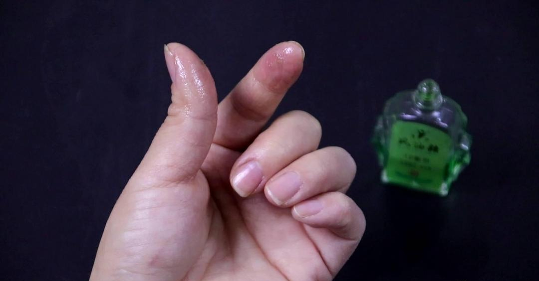 Tôi phát hiện ra 10 "bí mật" của dầu gió, xin khẳng định: Đây là "bảo bối"!- Ảnh 6. Tôi phát hiện ra 10 "bí mật" của dầu gió, xin khẳng định: Đây là "bảo bối"!- Ảnh 6.